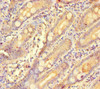 Immunohistochemistry of paraffin-embedded human small intestine tissue using CSB-PA009318LA01HU at dilution of 1:100