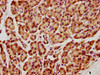 IHC image of CSB-PA010385HA01HU diluted at 1:1300 and staining in paraffin-embedded human pancreatic tissue performed on a Leica BondTM system. After dewaxing and hydration, antigen retrieval was mediated by high pressure in a citrate buffer (pH 6.0) . Section was blocked with 10% normal goat serum 30min at RT. Then primary antibody (1% BSA) was incubated at 4°C overnight. The primary is detected by a biotinylated secondary antibody and visualized using an HRP conjugated SP system.