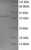 (Tris-Glycine gel) Discontinuous SDS-PAGE (reduced) with 5% enrichment gel and 15% separation gel.