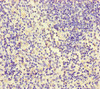 Immunohistochemistry of paraffin-embedded human spleen tissue using CSB-PA011867LA01HU at dilution of 1:100
