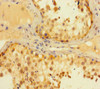 Immunohistochemistry of paraffin-embedded human testis tissue using CSB-PA013694HA01HU at dilution of 1:100