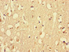 Immunohistochemistry of paraffin-embedded human brain tissue using CSB-PA015297LA01HU at dilution of 1:100