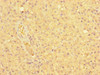 Immunohistochemistry of paraffin-embedded human adrenal gland tissue using CSB-PA015601LA01HU at dilution of 1:100