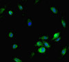 Immunofluorescent analysis of Hela cells using CSB-PA015744LA01HU at dilution of 1:100 and Alexa Fluor 488-congugated AffiniPure Goat Anti-Rabbit IgG (H+L)