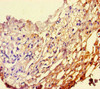 Immunohistochemistry of paraffin-embedded human thyroid tissue using CSB-PA017766HA01HU at dilution of 1:100