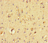 Immunohistochemistry of paraffin-embedded human brain tissue using CSB-PA018812LA01HU at dilution of 1:100