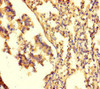 Immunohistochemistry of paraffin-embedded human lung tissue using CSB-PA018812LA01HU at dilution of 1:100