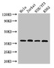 Western Blot<br />
 Positive WB detected in: Hela whole cell lysate, Jurkat whole cell lysate, NIH/3T3 whole cell lysate, K562 whole cell lysate<br />
 All lanes: RAD51 antibody at 2.7µg/ml<br />
 Secondary<br />
 Goat polyclonal to rabbit IgG at 1/50000 dilution<br />
 Predicted band size: 37, 27, 32 kDa<br />
 Observed band size: 37 kDa<br />