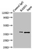 Immunoprecipitating RAD51 in K562 whole cell lysate<br />
 Lane 1: Rabbit control IgG (1µg) instead of CSB-PA019268LA01HU in K562 whole cell lysate.
 For western blotting, a HRP-conjugated Protein G antibody was used as the secondary antibody (1/50000) <br />
 Lane 2: CSB-PA019268LA01HU (4µg) + K562 whole cell lysate (500µg) <br />
 Lane 3: K562 whole cell lysate (20µg) <br />