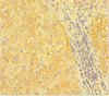 Immunohistochemistry of paraffin-embedded human liver tissue using CSB-PA019308HA01HU at dilution of 1:100