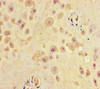 Immunohistochemistry of paraffin-embedded human placenta tissue using CSB-PA020808LA01HU at dilution of 1:100