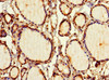 Immunohistochemistry of paraffin-embedded human thyroid tissue using CSB-PA021335LA01HU at dilution of 1:100