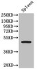 Western Blot<br />
 Positive WB detected in: Mouse spleen tissue<br />
 All lanes: SSTR2 antibody at 2.7µg/ml<br />
 Secondary<br />
 Goat polyclonal to rabbit IgG at 1/50000 dilution<br />
 Predicted band size: 42, 41 kDa<br />
 Observed band size: 42 kDa<br />