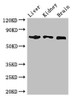 Western Blot<br />
 Positive WB detected in: Mouse liver tissue, Mouse kidney tissue, Mouse brain tissue<br />
 All lanes: TCF4 antibody at 2.7µg/ml<br />
 Secondary<br />
 Goat polyclonal to rabbit IgG at 1/50000 dilution<br />
 Predicted band size: 72, 55, 49, 66, 65, 58, 68, 64, 70, 69, 63 kDa<br />
 Observed band size: 72 kDa<br />