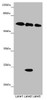 Western blot<br />
 All lanes: TOX3 antibody at 9 µg/ml<br />
 Lane 1: Mouse heart tissue<br />
 Lane 2: Mouse spleen tissue<br />
 Lane 3: Mouse brain tissue<br />
 Secondary<br />
 Goat polyclonal to rabbit IgG at 1/10000 dilution<br />
 Predicted band size: 63 kDa<br />
 Observed band size: 63, 24 kDa<br />