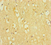 Immunohistochemistry of paraffin-embedded human brain tissue using CSB-PA024075LA01HU at dilution of 1:100