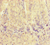 Immunohistochemistry of paraffin-embedded human adrenal gland tissue using CSB-PA025824LA01HU at dilution of 1:100