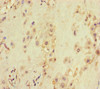 Immunohistochemistry of paraffin-embedded human placenta tissue using CSB-PA025824LA01HU at dilution of 1:100