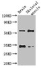 Western Blot<br />
 Positive WB detected in: Mouse brain tissue, Mouse skeletal muscle tissue<br />
 All lanes: VTN antibody at 2.8ug/ml<br />
 Secondary<br />
 Goat polyclonal to rabbit IgG at 1/50000 dilution<br />
 Predicted band size: 55 kDa<br />
 Observed band size: 55, 34 kDa<br />