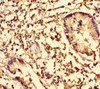 Immunohistochemistry of paraffin-embedded human appendix tissue using CSB-PA04709A0Rb at dilution of 1:100