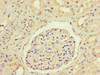 Immunohistochemistry of paraffin-embedded human kidney tissue using CSB-PA09689A0Rb at dilution of 1:100 Immunohistochemistry of paraffin-embedded human kidney tissue using CSB-PA09689A0Rb at dilution of 1:100