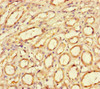 Immunohistochemistry of paraffin-embedded human kidney tissue using CSB-PA10509A0Rb at dilution of 1:100