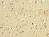 Immunohistochemistry of paraffin-embedded human brain tissue using CSB-PA10839A0Rb at dilution of 1:100