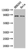 Western Blot<br />
 Positive WB detected in: HEK293 whole cell lysate, Hela whole cell lysate<br />
 All lanes: MLH1 antibody at 3µg/ml<br />
 Secondary<br />
 Goat polyclonal to rabbit IgG at 1/50000 dilution<br />
 Predicted band size: 85, 59, 74 kDa<br />
 Observed band size: 85 kDa<br />