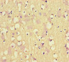 Immunohistochemistry of paraffin-embedded human brain tissue using CSB-PA17009A0Rb at dilution of 1:100