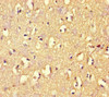 Immunohistochemistry of paraffin-embedded human brain tissue using CSB-PA413088LA01HU at dilution of 1:100
