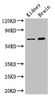 Western Blot<br />
 Positive WB detected in: Mouse kidney tissue, Mouse brain tissue<br />
 All lanes: ME3 antibody at 3µg/ml<br />
 Secondary<br />
 Goat polyclonal to rabbit IgG at 1/50000 dilution<br />
 Predicted band size: 68, 39 kDa<br />
 Observed band size: 68 kDa<br />