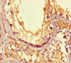 Immunohistochemistry of paraffin-embedded human testis tissue using CSB-PA618087LA01HU at dilution of 1:100