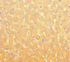 Immunohistochemistry of paraffin-embedded human liver tissue using CSB-PA618087LA01HU at dilution of 1:100