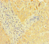 Immunohistochemistry of paraffin-embedded human liver tissue using CSB-PA624030HA01HU at dilution of 1:100
