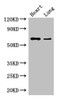 Western Blot<br />
 Positive WB detected in: Mouse heart tissue, Mouse lung tissue<br />
 All lanes: DCAF8 antibody at 3.5µg/ml<br />
 Secondary<br />
 Goat polyclonal to rabbit IgG at 1/50000 dilution<br />
 Predicted band size: 67, 31 kDa<br />
 Observed band size: 67 kDa<br />
