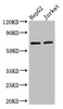 Western Blot<br />
 Positive WB detected in: HepG2 whole cell lysate, Jurkat whole cell lysate<br />
 All lanes: RUNX1T1 antibody at 2.8µg/ml<br />
 Secondary<br />
 Goat polyclonal to rabbit IgG at 1/50000 dilution<br />
 Predicted band size: 68, 65, 69, 64, 49, 45 kDa<br />
 Observed band size: 68 kDa<br />