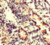 Immunohistochemistry of paraffin-embedded human appendix tissue using CSB-PA747798LA01HU at dilution of 1:100