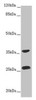Western blot<br />
 All lanes: RAB12 antibody at 2µg/ml + Hela whole cell lysate<br />
 Secondary<br />
 Goat polyclonal to rabbit IgG at 1/10000 dilution<br />
 Predicted band size: 28 kDa<br />
 Observed band size: 28, 36 kDa<br />