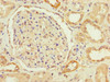 Immunohistochemistry of paraffin-embedded human kidney tissue using CSB-PA764718LA01HU at dilution of 1:100