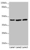 Western blot<br />
 All lanes: MTERF4 antibody at 2 µg/ml<br />
 Lane 1: Mouse kidney tissue<br />
 Lane 2: HL60 whole cell lysate<br />
 Lane 3: A549 whole cell lysate<br />
 Secondary<br />
 Goat polyclonal to rabbit IgG at 1/10000 dilution<br />
 Predicted band size: 44 kDa<br />
 Observed band size: 44 kDa<br />