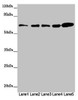 Western blot<br />
 All lanes: ZBTB46 antibody at 2µg/ml<br />
 Lane 1: Mouse heart tissue<br />
 Lane 2: Mouse liver tissue<br />
 Lane 3: Mouse kidney tissue<br />
 Lane 4: 293T whole cell lysate<br />
 Lane 5: SH-SY5Y whole cell lysate<br />
 Secondary<br />
 Goat polyclonal to rabbit IgG at 1/10000 dilution<br />
 Predicted band size: 65 kDa<br />
 Observed band size: 65 kDa<br />