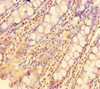 Immunohistochemistry of paraffin-embedded human colon tissue using CSB-PA803124HA01HU at dilution of 1:100