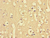 Immunohistochemistry of paraffin-embedded human brain tissue using CSB-PA809015LA01HU at dilution of 1:100