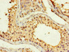 Immunohistochemistry of paraffin-embedded human testis tissue using CSB-PA815554LA01HU at dilution of 1:100