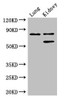 Western Blot<br />
 Positive WB detected in: Mouse lung tissue, Mouse kidney tissue<br />
 All lanes: LEPREL1 antibody at 3µg/ml<br />
 Secondary<br />
 Goat polyclonal to rabbit IgG at 1/50000 dilution<br />
 Predicted band size: 81, 61 kDa<br />
 Observed band size: 81, 61 kDa<br />