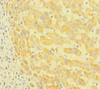 Immunohistochemistry of paraffin-embedded human liver tissue using CSB-PA815555HA01HU at dilution of 1:100