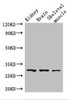 Western Blot<br />
 Positive WB detected in: Mouse kidney tissue, Mouse brain tissue, Mouse skeletal muscle tissue<br />
 All lanes: PLD6 antibody at 2.5µg/ml<br />
 Secondary<br />
 Goat polyclonal to rabbit IgG at 1/50000 dilution<br />
 Predicted band size: 29 kDa<br />
 Observed band size: 29 kDa<br />