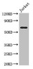 Western Blot<br />
 Positive WB detected in: Jurkat whole cell lysate<br />
 All lanes: SLC38A9 antibody at 3.5µg/ml<br />
 Secondary<br />
 Goat polyclonal to rabbit IgG at 1/50000 dilution<br />
 Predicted band size: 64, 53, 57 kDa<br />
 Observed band size: 64 kDa<br />