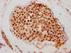 IHC image of CSB-PA843310HA01HU diluted at 1:700 and staining in paraffin-embedded human testis tissue performed on a Leica BondTM system. After dewaxing and hydration, antigen retrieval was mediated by high pressure in a citrate buffer (pH 6.0) . Section was blocked with 10% normal goat serum 30min at RT. Then primary antibody (1% BSA) was incubated at 4°C overnight. The primary is detected by a biotinylated secondary antibody and visualized using an HRP conjugated SP system.