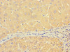 Immunohistochemistry of paraffin-embedded human liver tissue using CSB-PA846095LA01HU at dilution of 1:100